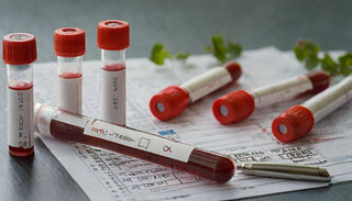 Functional_Blood_Labs.jpg__PID:27563f30-a7f1-4a70-82ea-205b5cdc30d2